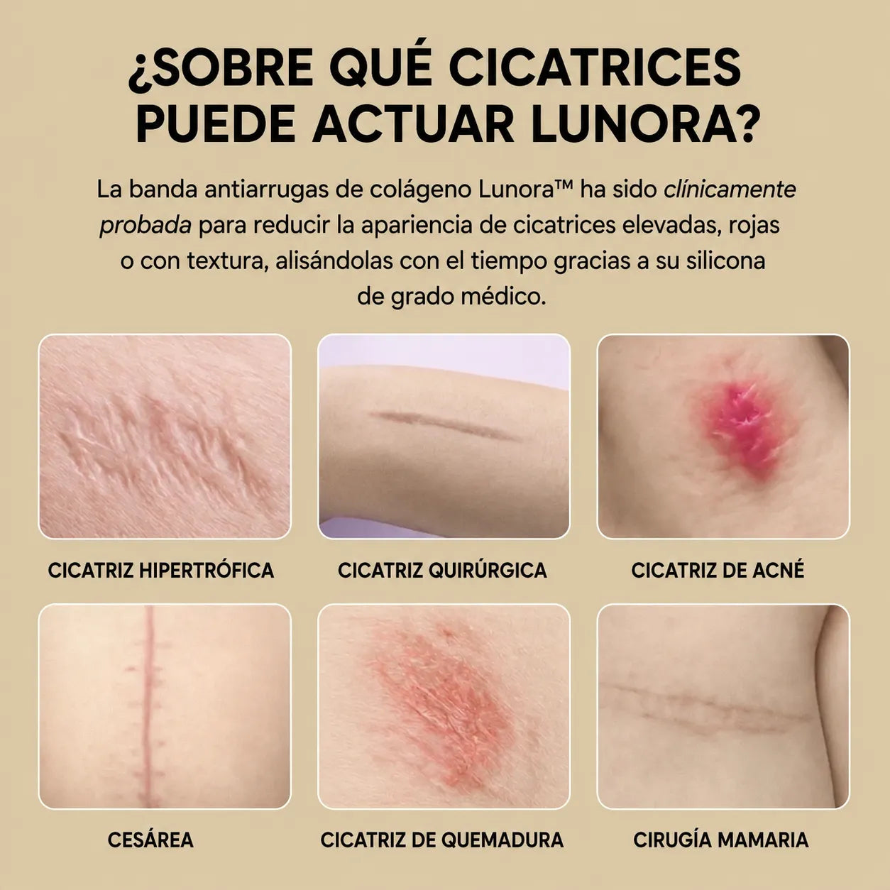 Lunora — Parches lifting de silicona