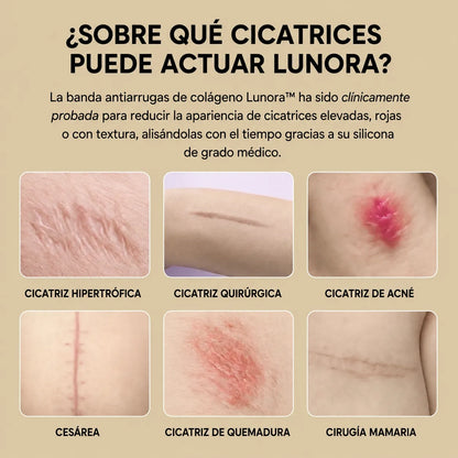 Lunora — Parches lifting de silicona